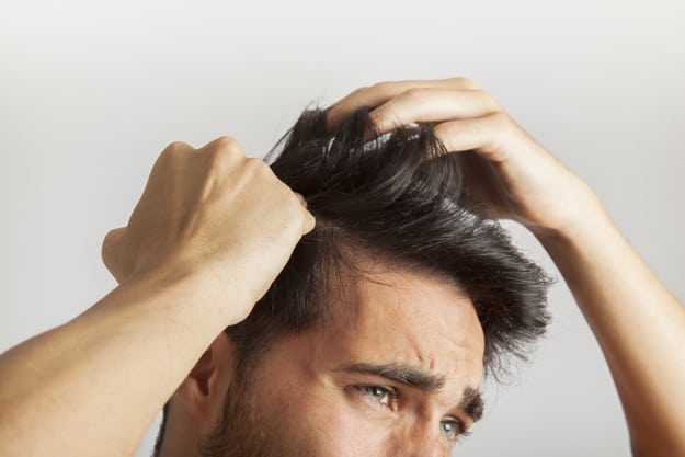 أسباب تساقط  الشعر عند الرجال 